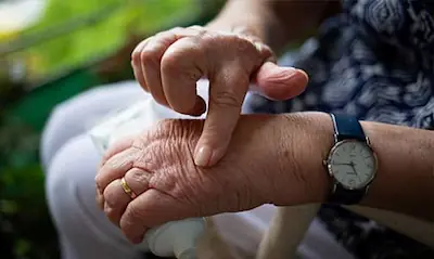 Inflamación y dolor en LauraSan